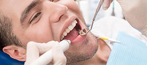 Top Cosmetic Dentist Near Me in Mesquite TX