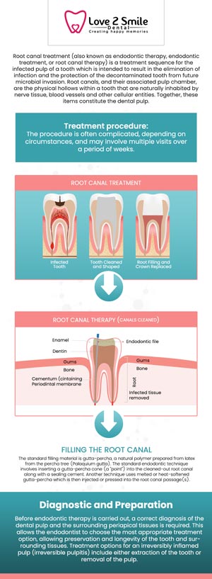 Save a badly damaged or infected tooth by getting root canal treatment at Love 2 Smile Dental Practice from experienced and trusted Dr. Divya Nagaraj DDS. There are more common signs than anything like pain, swelling, or the sensation of heat in your gums, but it would be best to go in once every 6 to 12 months for a check-up and cleaning. Connect with us with any questions you may have or, when ready, you can schedule an appointment online at your earliest convenience. We are located at 1050 N Bryan-Belt Line Rd Ste 102, Mesquite, TX 75149.