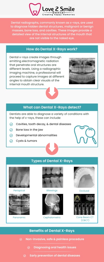 Dental X-rays are an essential diagnostic tool used to detect hidden dental problems that cannot be seen during a routine oral exam. At Love 2 Smile Dental Practice in Mesquite, TX, Dr. Divya Nagaraj, DDS, uses advanced dental X-rays for accurate diagnosis and precise treatment planning. These images help identify cavities, infections, bone loss, impacted teeth, and other underlying oral health issues at an early stage. By providing a clear view of the teeth and supporting structures, dental X-rays play a key role in preventive care and help ensure long-term dental health and timely treatment. For more information, contact us today or book an appointment online. We are located at 1050 N Bryan-Belt Line Rd Ste 102, Mesquite, TX 75149. Dental X-rays are an essential diagnostic tool used to detect hidden dental problems that cannot be seen during a routine oral exam. At Love 2 Smile Dental Practice in Mesquite, TX, Dr. Divya Nagaraj, DDS, uses advanced dental X-rays for accurate diagnosis and precise treatment planning. These images help identify cavities, infections, bone loss, impacted teeth, and other underlying oral health issues at an early stage. By providing a clear view of the teeth and supporting structures, dental X-rays play a key role in preventive care and help ensure long-term dental health and timely treatment. For more information, contact us today or book an appointment online. We are located at 1050 N Bryan-Belt Line Rd Ste 102, Mesquite, TX 75149.
