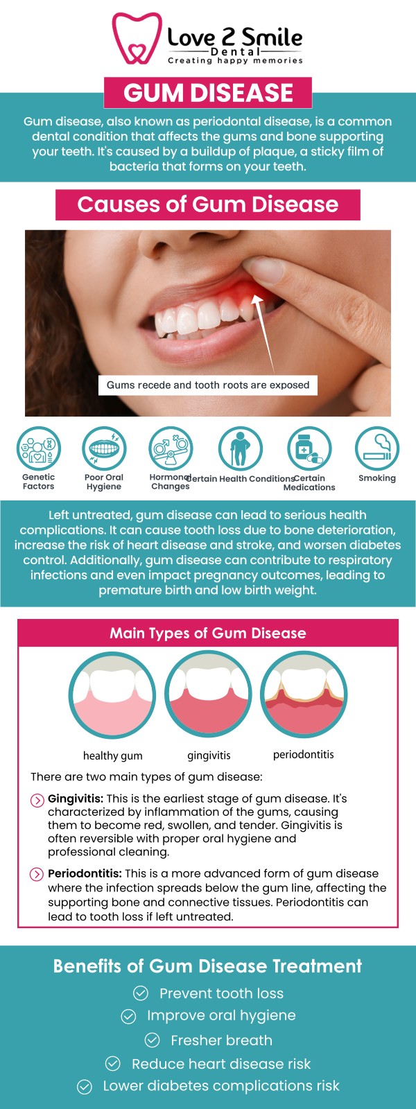 Gum bleeding and swelling are common signs of inflammation caused by plaque buildup along the gumline. This condition often occurs due to poor oral hygiene, which allows bacteria to irritate and infect the gums. If left untreated, it may progress into gingivitis or more advanced gum disease, leading to discomfort and potential tooth damage. Early dental care is important to restore gum health and prevent further complications. At Love 2 Smile Dental Practice, Dr. Divya Nagaraj, DDS, and the team in Mesquite, TX provide personalized evaluation and treatment to reduce gum inflammation and restore healthy gums. For more information, contact us today or book an appointment online. We are located at 1050 N Bryan-Belt Line Rd Ste 102, Mesquite, TX 75149. Gum bleeding and swelling are common signs of inflammation caused by plaque buildup along the gumline. This condition often occurs due to poor oral hygiene, which allows bacteria to irritate and infect the gums. If left untreated, it may progress into gingivitis or more advanced gum disease, leading to discomfort and potential tooth damage. Early dental care is important to restore gum health and prevent further complications. At Love 2 Smile Dental Practice, Dr. Divya Nagaraj, DDS, and the team in Mesquite, TX provide personalized evaluation and treatment to reduce gum inflammation and restore healthy gums. For more information, contact us today or book an appointment online. We are located at 1050 N Bryan-Belt Line Rd Ste 102, Mesquite, TX 75149.