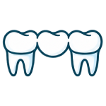 Dental Bridges