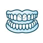 Spark™ Clear Aligners